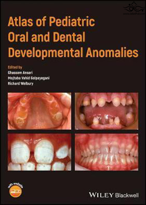 Atlas of Pediatric Oral and Dental Developmental Anomalies2019  John Wiley and Sons Ltd 